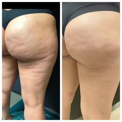 CelluSoothe™ Anti-Cellulite Body Oil – Firming, Smoothing & Skin-Toning Treatment